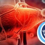 World Hepatitis Day 2025 calls for collective action, early screening, and improved access to modern treatments